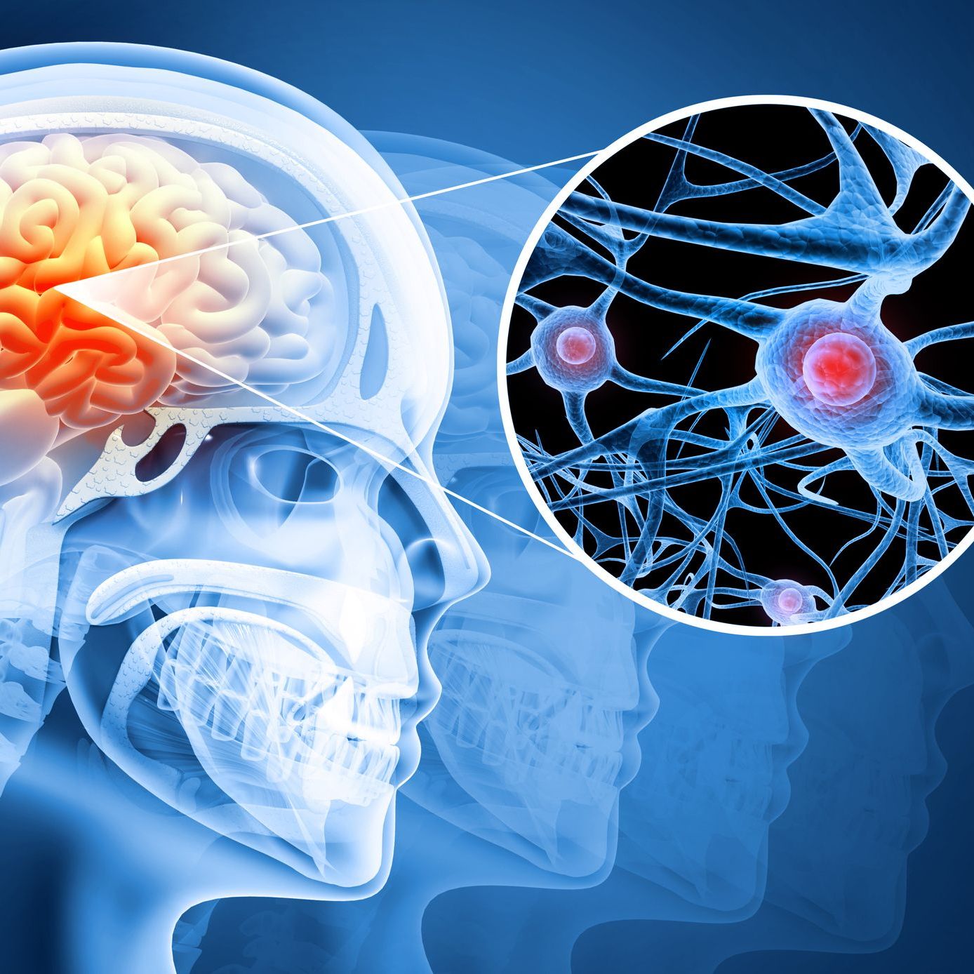 Human brain damage and treatment concept Human brain damage and treatment concept