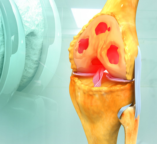 An-anatomy-of-human-knee-joint