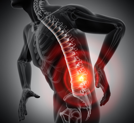 Back-pain-conceptual-3d-illustration