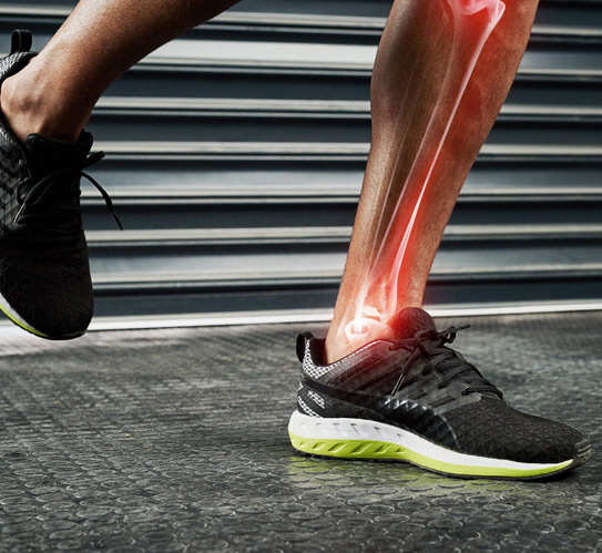 Closeup-shot-of-an-athlete's-legs-with-an-inflammation