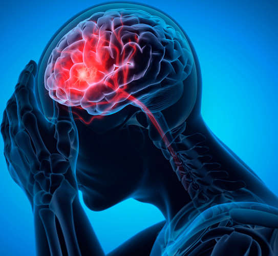 Image-illustration-of-a-man-with-brain-stroke