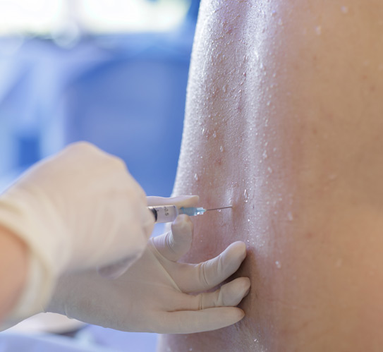 Physician-lumbar-sympathetic-block-injection