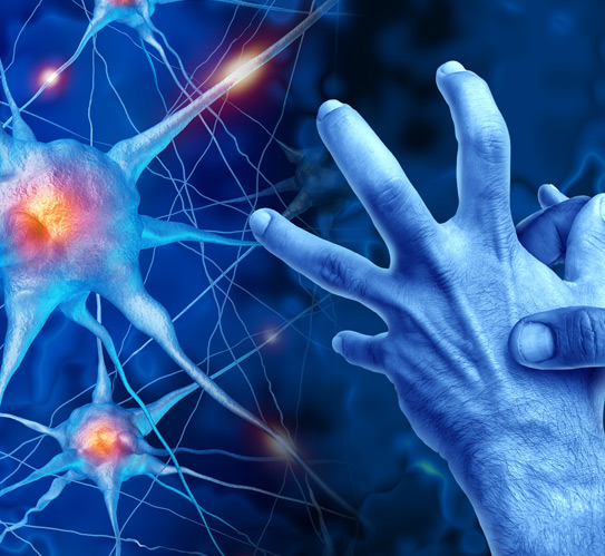 Progressive-neurological-disorder-affecting-body-movement-and-coordination