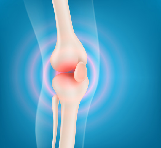 Vector-illustration-of-a-human-knee-joint-anatomy-highlighting-pain-areas