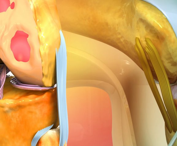 3D-illustration-of-ligament-and-joint-inflammation