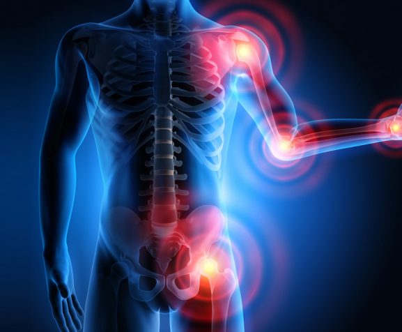 3d-Illustration-of-pain-in-all-joints