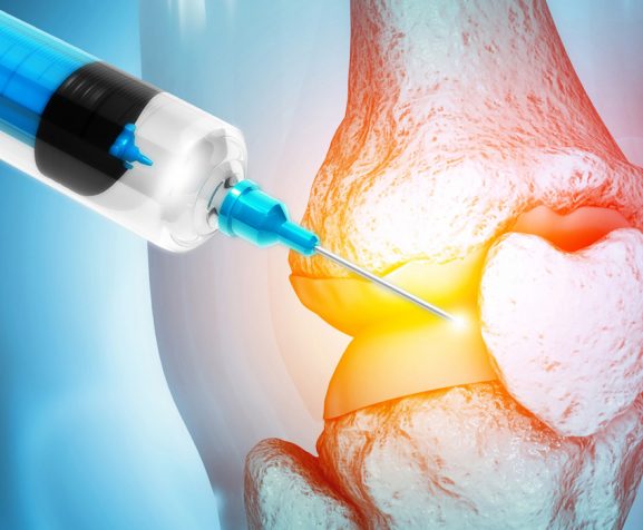 Anatomy-human-knee-joint-treatment