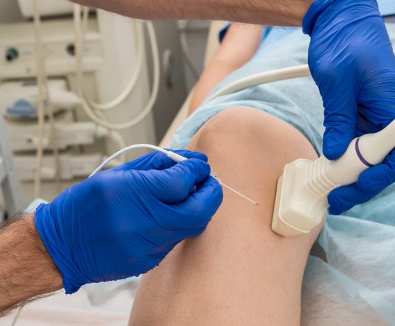 Doctor-using-radiofrequency-catheter-ablation-on-patient