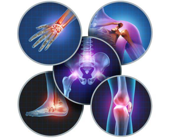 Human-painful-joints-concept-with-the-skeleton-anatomy-of-the-body