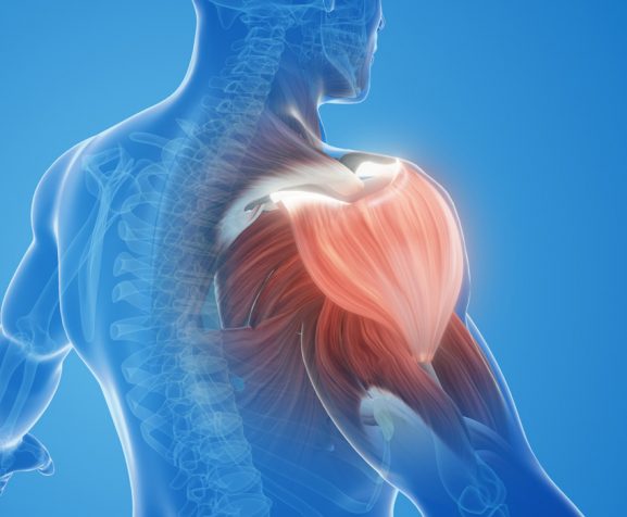 Image-illustration-of-shoulder-muscle-pain-and-injury