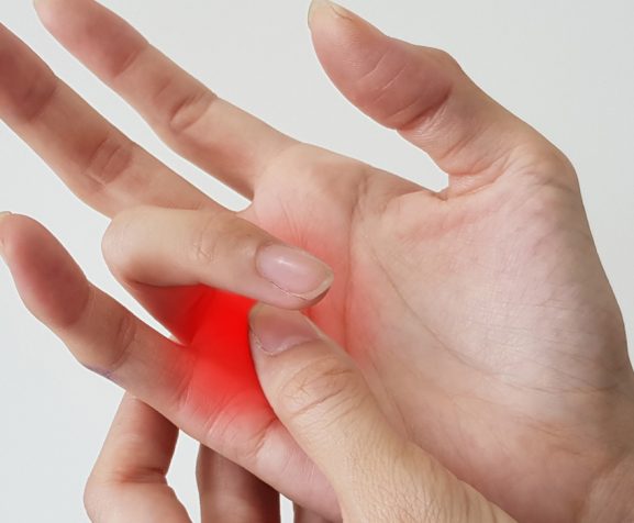 Photo-illustrating-trigger-finger-disease-with-highlighted-painful-area