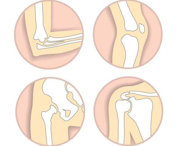 Set-of-human-joints,-elbow,-knee,-hip-and-shoulder-joint